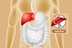 Fatty Liver lifestyle changes, Fatty Liver prevention, dangers of fatty liver, Event