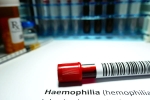 Hemophilia in men, Hemophilia latest, why are men likely to develop hemophilia, Mutation