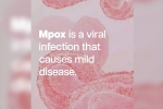 health emergency, mpox break down, mpox emergency again, Mortality