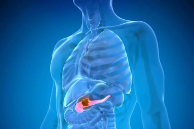 How To Protect Yourself from Pancreatic Cancer?