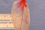 WPI Scientists Develop Patch For Diseased Hearts, Patch For Diseased Hearts, patch for diseased hearts using spinach leaves, Drummer
