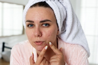 This Drink may help Get Rid of Stubborn Pimples This Drink may help Get Rid of Stubborn Pimples