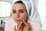 This Drink may help Get Rid of Stubborn Pimples This Drink may help Get Rid of Stubborn Pimples