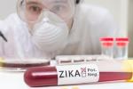 FDA, Zika screening, fda expands zika screening to all us blood centers, Zika virus FDA, Zika screening, fda expands zika screening to all us blood centers, Zika virus
